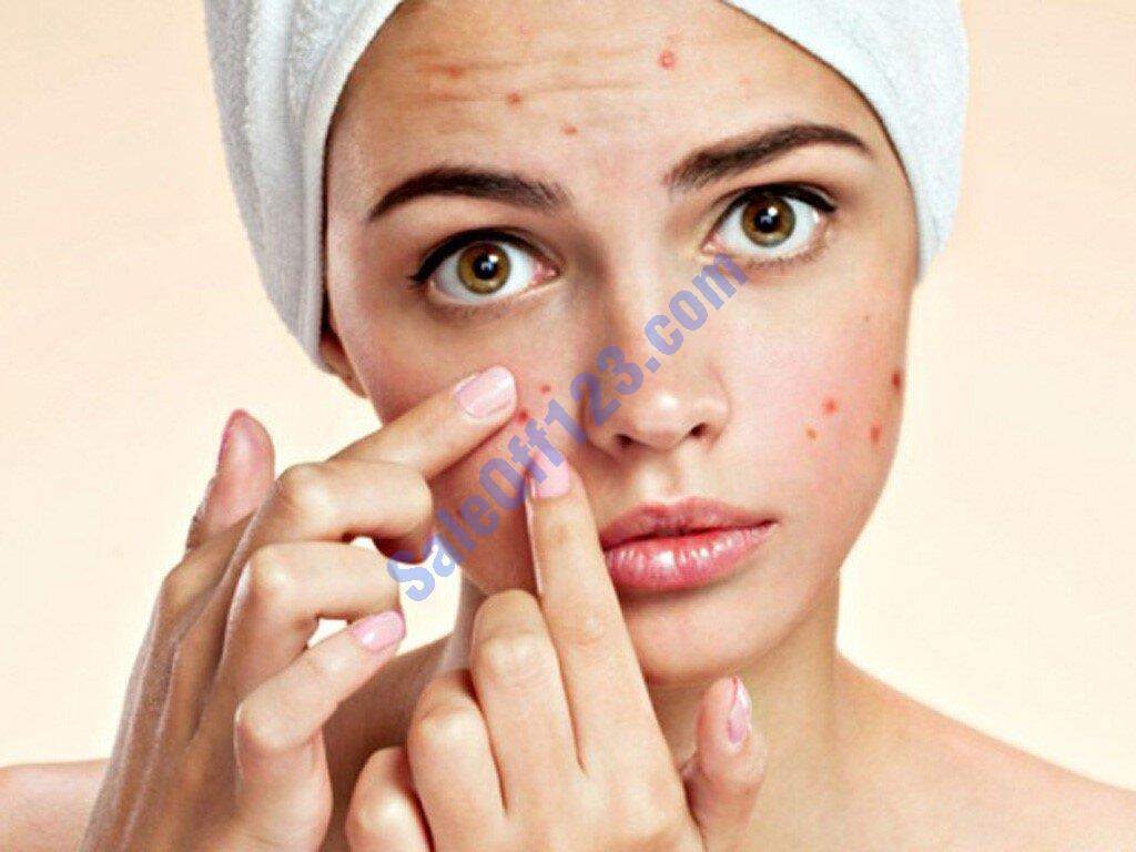 4 cách trị mụn bằng tinh dầu bưởi giảm tiết nhờn làm sáng da mặt