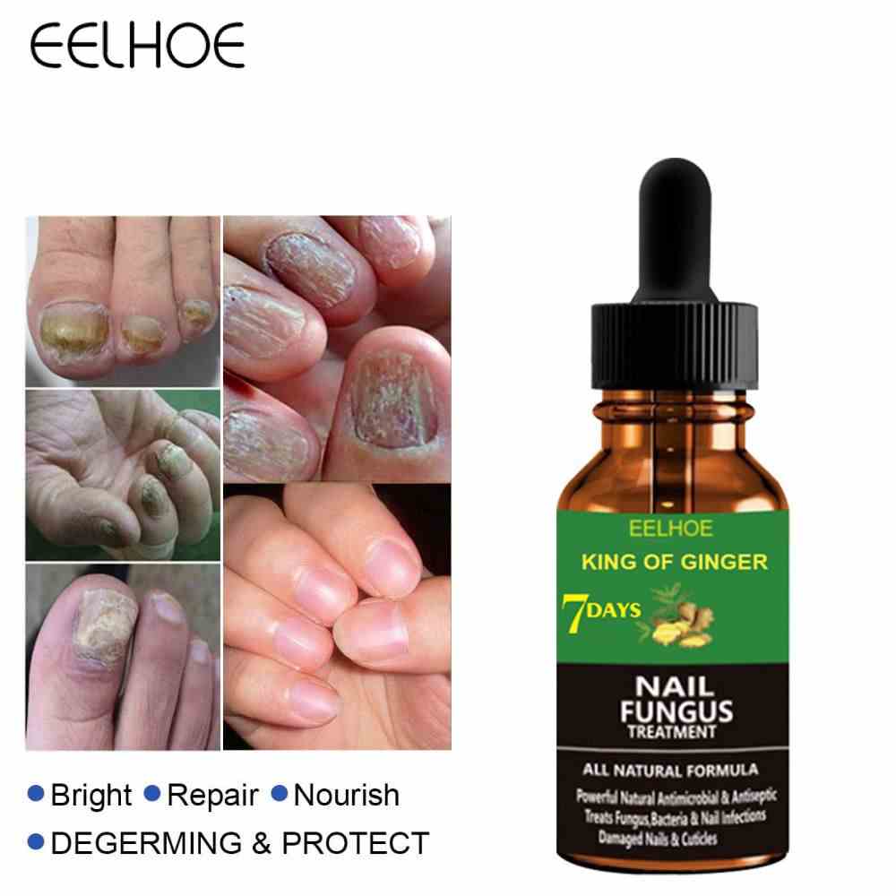 EELHOE 30/50Ml Tinh Chất Chống Nấm Chân Gừng Để Loại Bỏ Nấm Móng Dạng Lỏng Điều Trị Sửa Chữa Chăm Sóc Móng Khỏe Mạnh-Ampe