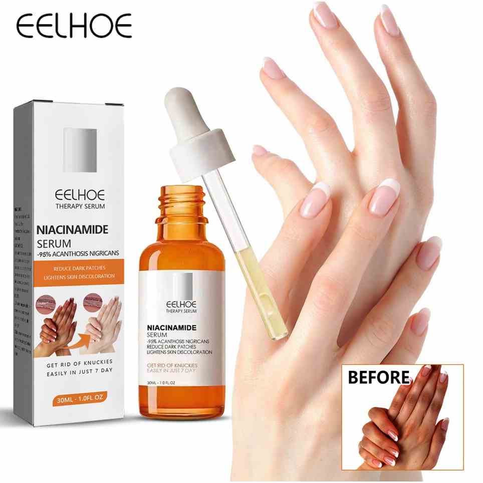 Serum tinh chất làm trắng da EELHOE Acanthosis Nigricans xóa mờ vết thâm khử đen melanin đa năng hiệu quả