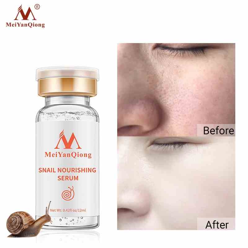 Serum Dưỡng Phục Hồi Tinh Chất Ốc Sên MeiYanQiong 12ml Dưỡng Trắng Da Và Thu Nhỏ Lỗ Chân Lông Cải Thiện Vết Thâm Lõm Snail Repair Serum 12ML