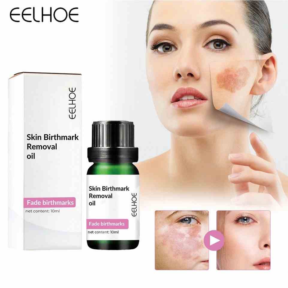 Dầu loại bỏ vết bớt EELHOE 10ml chăm sóc da